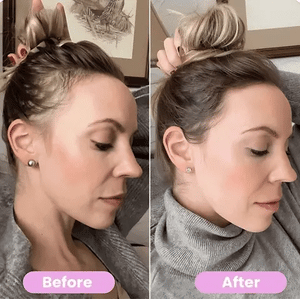 Vellora Light Scalp Massager Brush