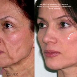VELLORA 7-in-1 LED Facial Sculptor