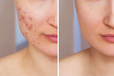 One mask. A renewed face. A renewed you.