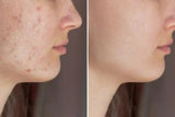 One mask. A renewed face. A renewed you.