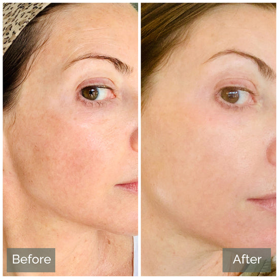 Sérum visage 5 en 1 JAYSUING à l'acide hyaluronique et à la vitamine C