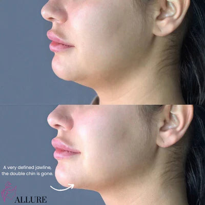 VELLORA 7-in-1 LED Facial Sculptor