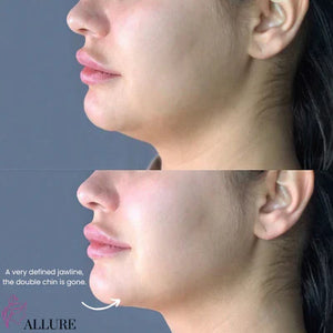 VELLORA 7-in-1 LED Facial Sculptor