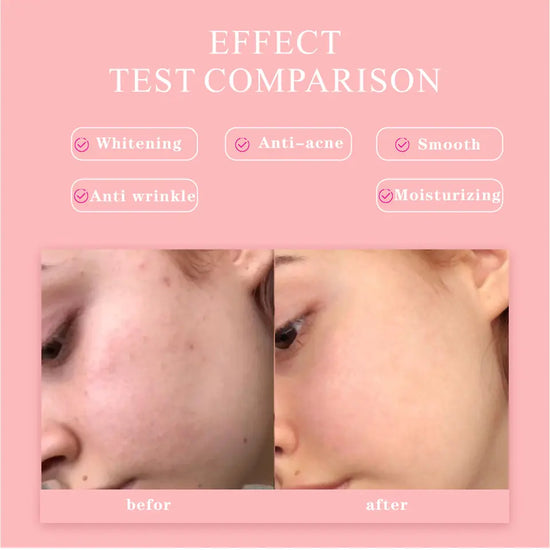 Sérum visage 5 en 1 JAYSUING à l'acide hyaluronique et à la vitamine C